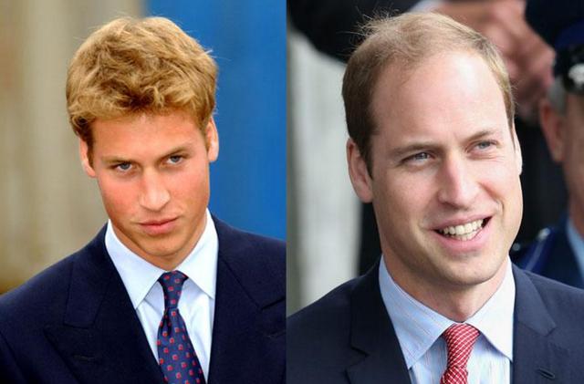 英國威廉王子「遭笑禿頭多年」，他索性直接「花7300元把頭髮剃光」所有人目瞪口呆！