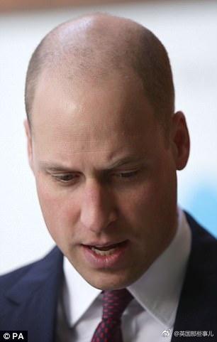 英國威廉王子「遭笑禿頭多年」，他索性直接「花7300元把頭髮剃光」所有人目瞪口呆！