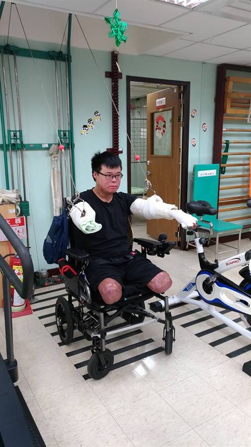 八仙塵爆傷者「雙腿+右手截肢」存活率僅5%！他淚述「爸媽每天笑著報時」背後原因讓大家哭了！