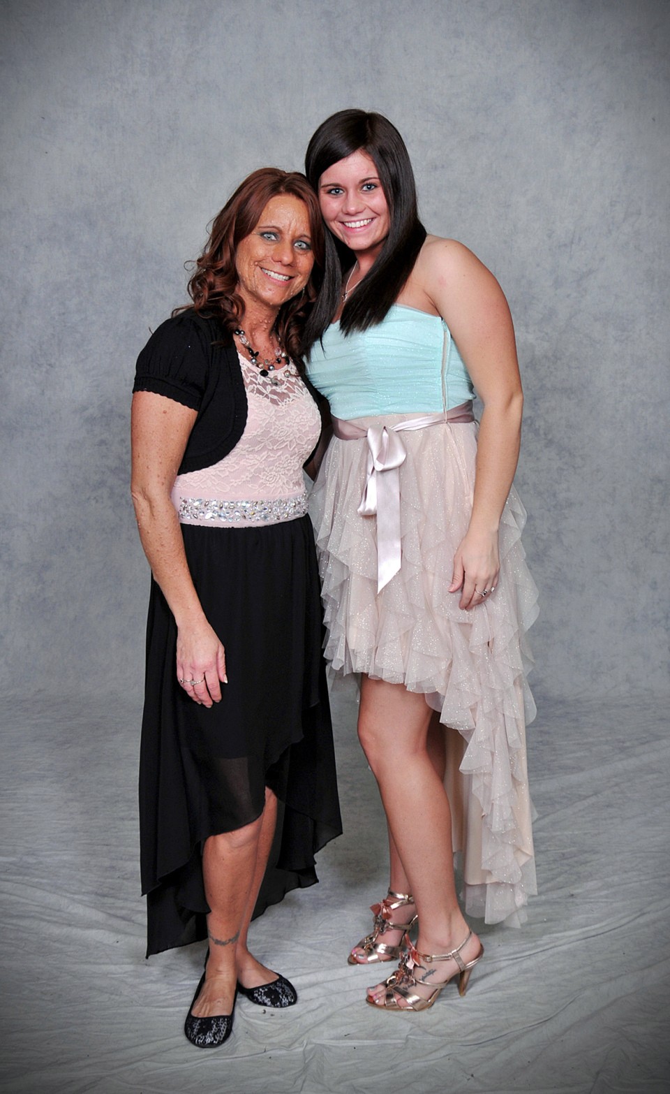 她「全身長滿6000顆腫瘤」被笑癩蝦蟆沒人敢接近，如今「成功移除臉部肉瘤」現平滑美肌！