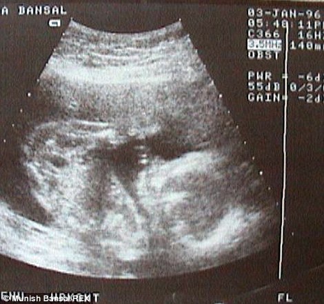 爸爸「從女兒在子宮」就開始拍照記錄，18年後「用6575張照片拼出滿滿父愛」最後1張美翻！