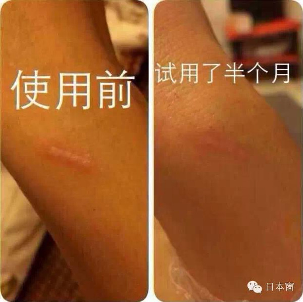 秋冬皮膚乾燥！日本馬油太實用了「全身保濕」六大用法大公開「護膚祛斑」 歡迎分享學習