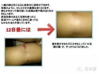 秋冬皮膚乾燥！日本馬油太實用了「全身保濕」六大用法大公開「護膚祛斑」 歡迎分享學習