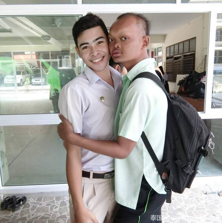 19歲少女「沒有鼻樑」醜到被社會嫌棄！模特兒公司意外相中「醜小鴨變天鵝」贏得選美！