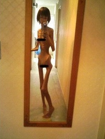 她童年被阿公虐待「偷吃東西就狠踢」瘦成骨！獲救10年後「養胖變女神」讓人超驚艷！