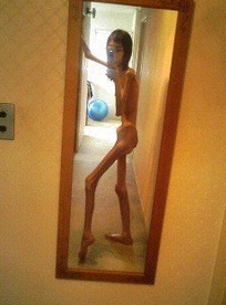 她童年被阿公虐待「偷吃東西就狠踢」瘦成骨！獲救10年後「養胖變女神」讓人超驚艷！