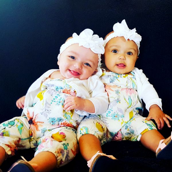 白人媽媽生雙胞胎「膚色一黑一白」被鄰居懷疑，醫生卻說「絕對是...」眾人超訝異！