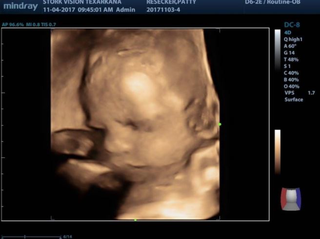 自己的孫子自己生！她17歲失去子宮無法懷孕　50歲婆婆：「沒關係我幫妳生」暖哭全球！