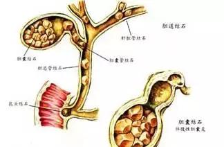 「生什麼病  忌什麼口」留著一張養生表，不用問醫生