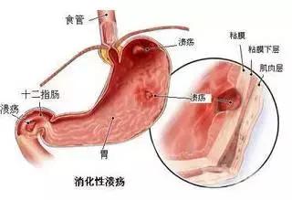 「生什麼病  忌什麼口」留著一張養生表，不用問醫生