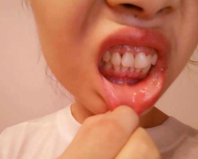 想保護好自己的肝，3種食物不該多吃，吃多了當心「肝臟受損」！