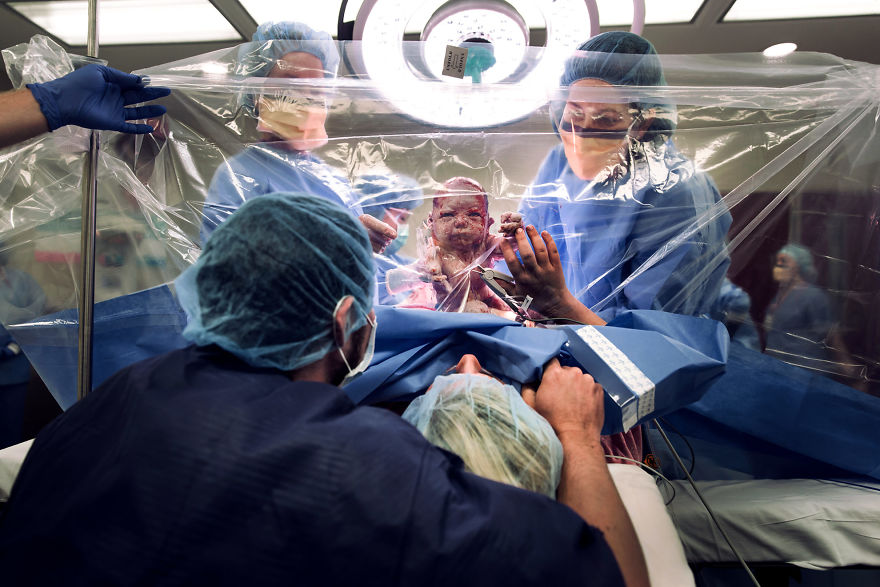 19張紀錄「母親與新生兒初次見面」的獲獎照片。#7媽媽和嬰兒「第一次觸摸彼此」感動全球！