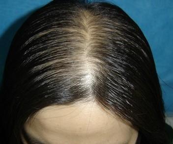 洗完頭老是掉一堆頭髮？原來很多人都「洗」錯了！正確的「洗頭方式」應該是…