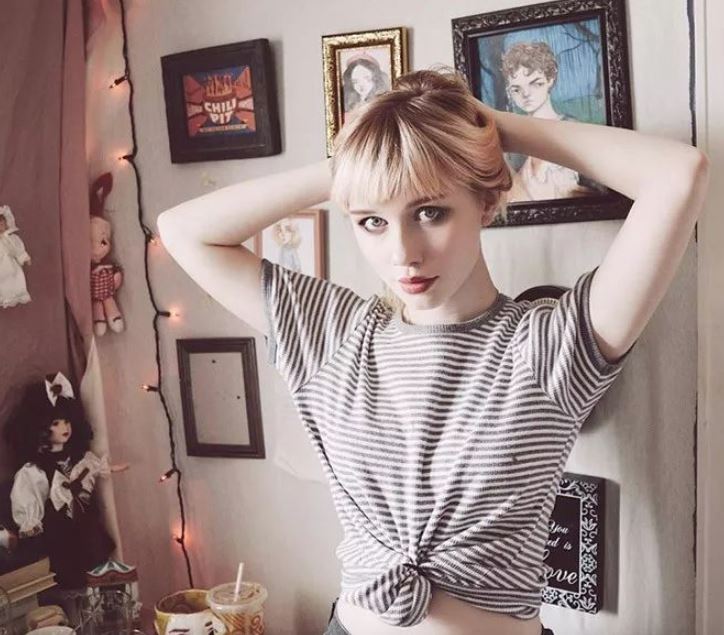 超人氣網紅「6年不敢素顏」正到狂吸粉絲，勇敢公開「滿臉爛痘真面目」粉絲不減還暴增！