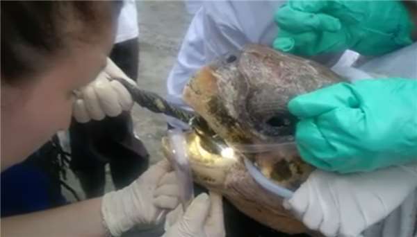 海龜忍著痛「嘴巴被撬開」！救援志工用力拉出一大條...網友心痛：都是人類害了牠QQ