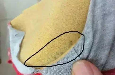 女子身體癢得受不了！醫生讓她「把內衣剪開」... 翻開一看讓她差點嚇暈！