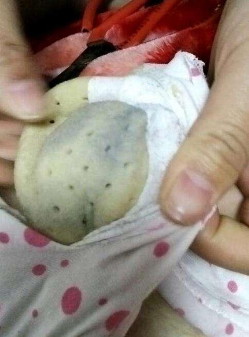 女子身體癢得受不了！醫生讓她「把內衣剪開」... 翻開一看讓她差點嚇暈！