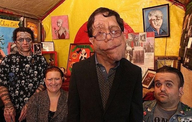 可愛雙胞胎人人羨，孰料「弟弟長大很英俊、哥哥卻變怪物」！最後結局竟「完全相反」讓人落淚...