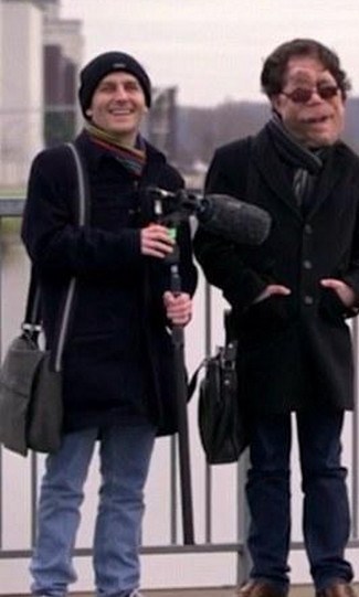 可愛雙胞胎人人羨，孰料「弟弟長大很英俊、哥哥卻變怪物」！最後結局竟「完全相反」讓人落淚...