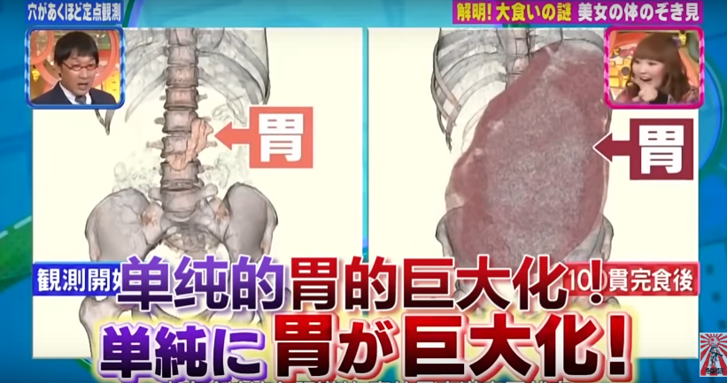 大胃王挑戰吃下「約4公斤的100個壽司」　沒想到吃完後她「身體變化」讓醫生都不敢相信