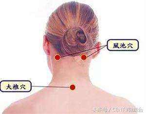 後方肩頸「突起1包」是因為太胖？不只不好看還會痛...簡單5招消除「富貴包」！