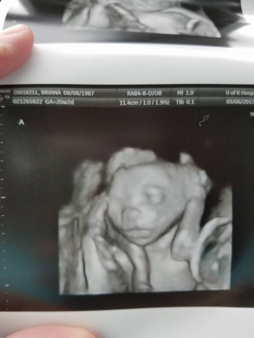 老婆「不孕2年」絕望放棄　半年後醫生一看「超音波畫面怪怪的」嚇傻：妳破紀錄了！