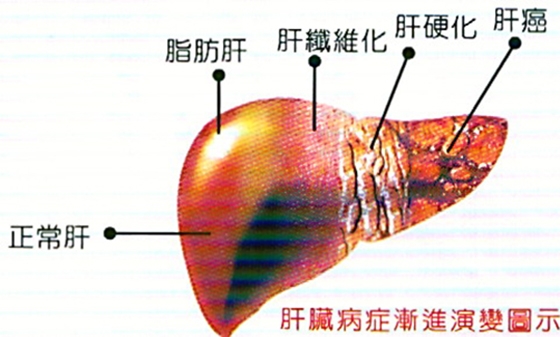 如果「肝不好」就容易疲勞，教你每天只花幾分鐘「簡單小動作」把健康的肝養回來！