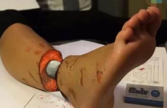 女子午睡醒來驚見「自己的腿」放聲尖叫！沒想到丈夫竟對她做「一件事」...差點被她打死！