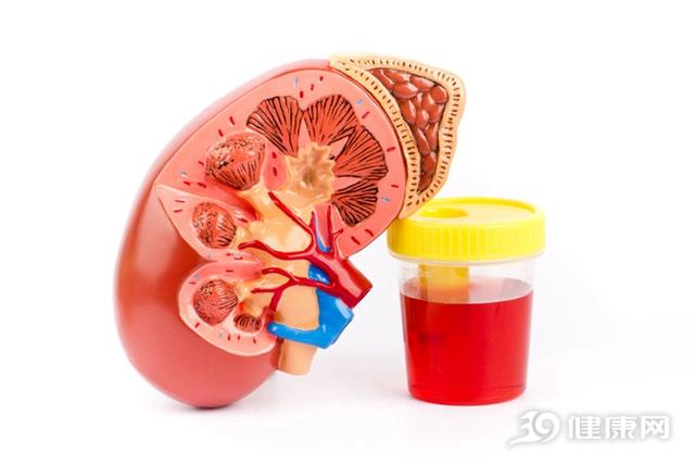5種水果是腎臟「最愛」！如果你腎不好，請多吃！