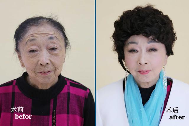 71歲阿嬤為了嫁給年輕帥哥，花光所有財產跑去「整型成30歲少婦」，變化超大！