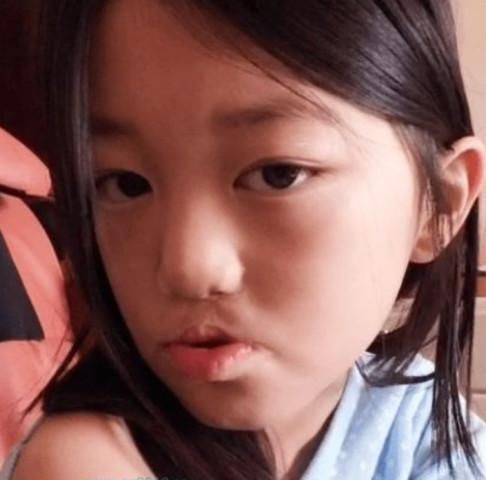 當年王菲堅持生下「兔唇女兒」，不惜砸重金讓女兒「3次整容」，長大後的她「如今模樣」...