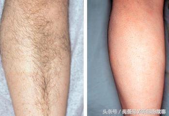 無論男女！腳有5種「症狀」就要小心了  「腳麻」現在知道還來得及