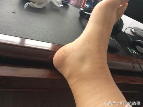 無論男女！腳有5種「症狀」就要小心了  「腳麻」現在知道還來得及