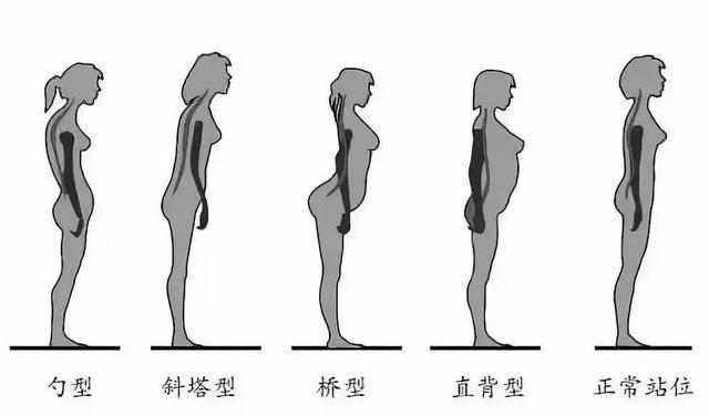背薄一寸，命長十年！一套「養背操」幫你強健脊背，告別背痛