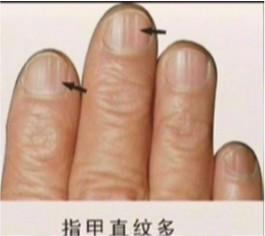 你的「壽命」有多長？你的「手指頭」已經悄悄暴露給別人知道了