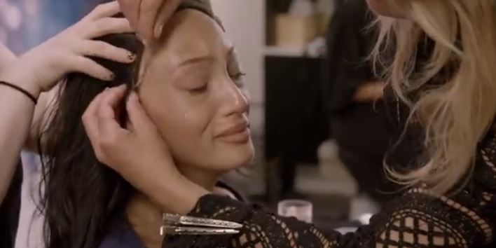 24歲超模「整頭全禿」從小戴假髮　勇闖時尚圈「鏡頭前落淚拆下假髮」惹哭全球：最真實的我