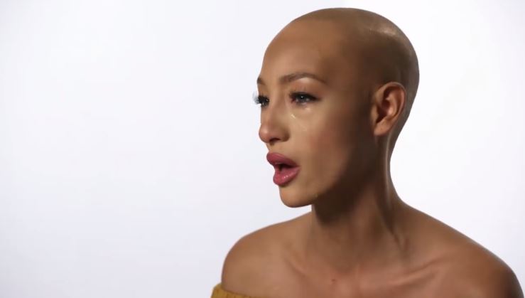 24歲超模「整頭全禿」從小戴假髮　勇闖時尚圈「鏡頭前落淚拆下假髮」惹哭全球：最真實的我