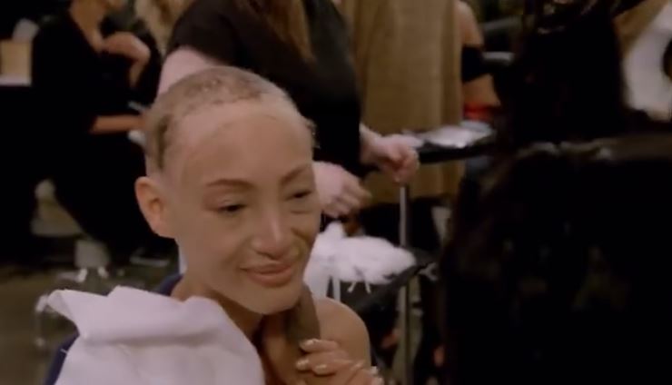 24歲超模「整頭全禿」從小戴假髮　勇闖時尚圈「鏡頭前落淚拆下假髮」惹哭全球：最真實的我