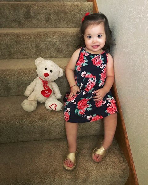 2歲小女娃「黑亮水汪汪大眼」爆紅全網　醫生「一眼看出不對勁」警醒全球父母：這有問題