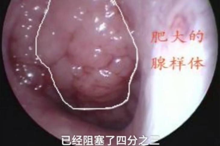 女兒可愛臉蛋「變成人面魚」爸爸懷疑戴綠帽　做DNA鑑定「結果讓醫生傻眼」：是爸爸的錯