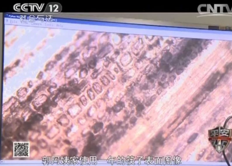 一家4口無一倖免！天天用「廚房致癌物」病菌全下肚  「使用效期6個月」為命別省