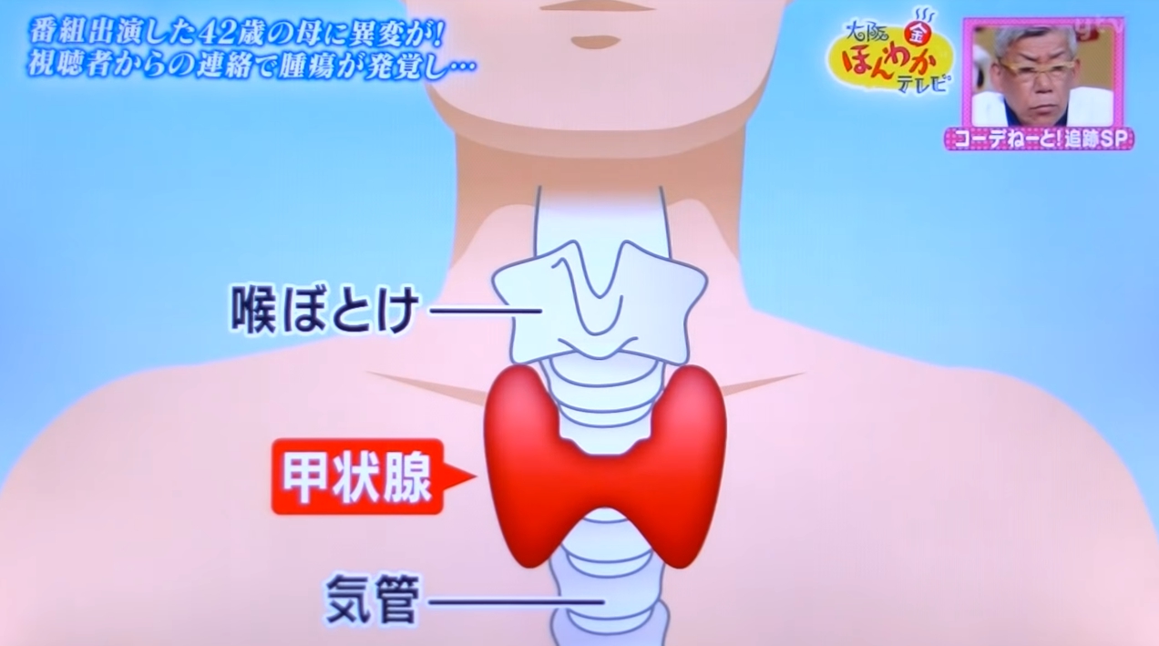 42歲大媽上節目改造超美！觀眾看到「脖子腫腫的...」要她快就醫   一看結果全腿軟：好眼力救回一命  