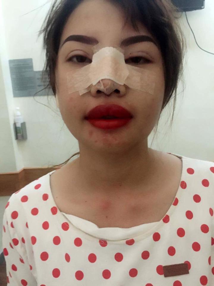 越南妹「被嫌沒人敢娶」狠砸50萬大改造　如今逆轉人生「披上奢華婚紗」正到嫁給富二代