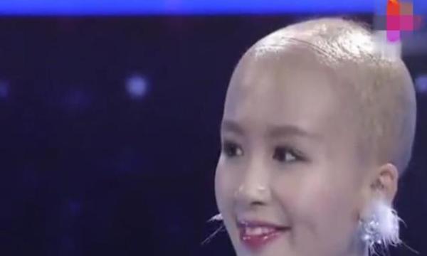 天生寸頭女孩戴了20多年假髮,摘下頭套,網友直呼:想娶回家