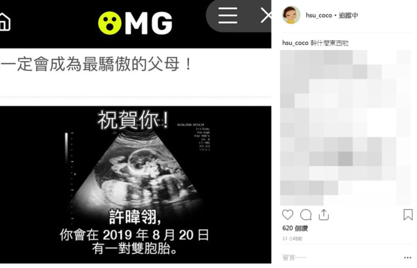 徐小可又懷孕?她無預警PO「雙胞胎超音波照」好驚喜 網友驚見「預產期在這天」好日子近了