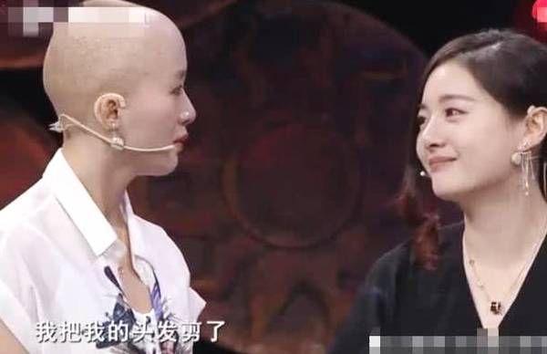 世紀好友！她自斷秀髮「為光頭20年摯友」做假髮　 好友戴上假髮後「秒變女神」：一切都值了♥