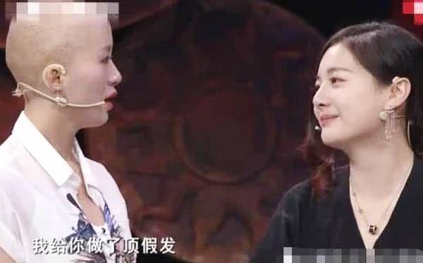 世紀好友！她自斷秀髮「為光頭20年摯友」做假髮　 好友戴上假髮後「秒變女神」：一切都值了♥
