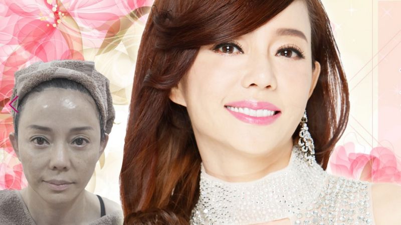 狄鶯代言醫美補錢坑「照片被無預警下架」 診所出面喊「我們是為了她好」曝光背後內幕