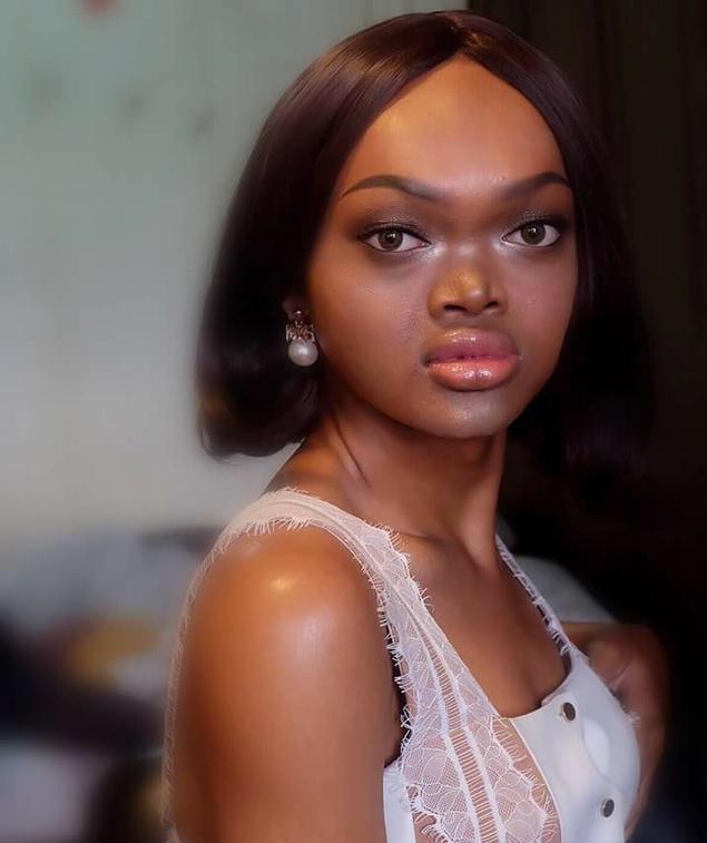 19歲少女「天生沒鼻樑」被整個社會嫌棄 意外被模特兒公司相中「上演醜女大翻身」贏得選美!