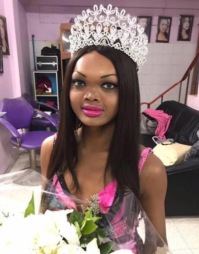 19歲少女「天生沒鼻樑」被整個社會嫌棄 意外被模特兒公司相中「上演醜女大翻身」贏得選美!